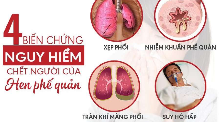 Biến chứng nguy hiểm của hen phế quản